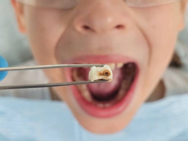 Best Urgent Dental Care for Toothaches in Eureka, KS